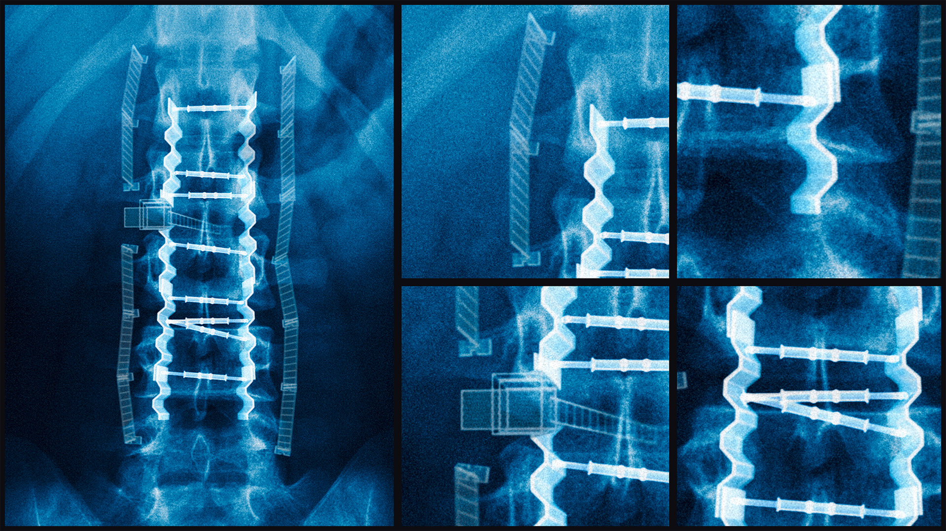 BGBAU_X-Ray_Close-ups_02