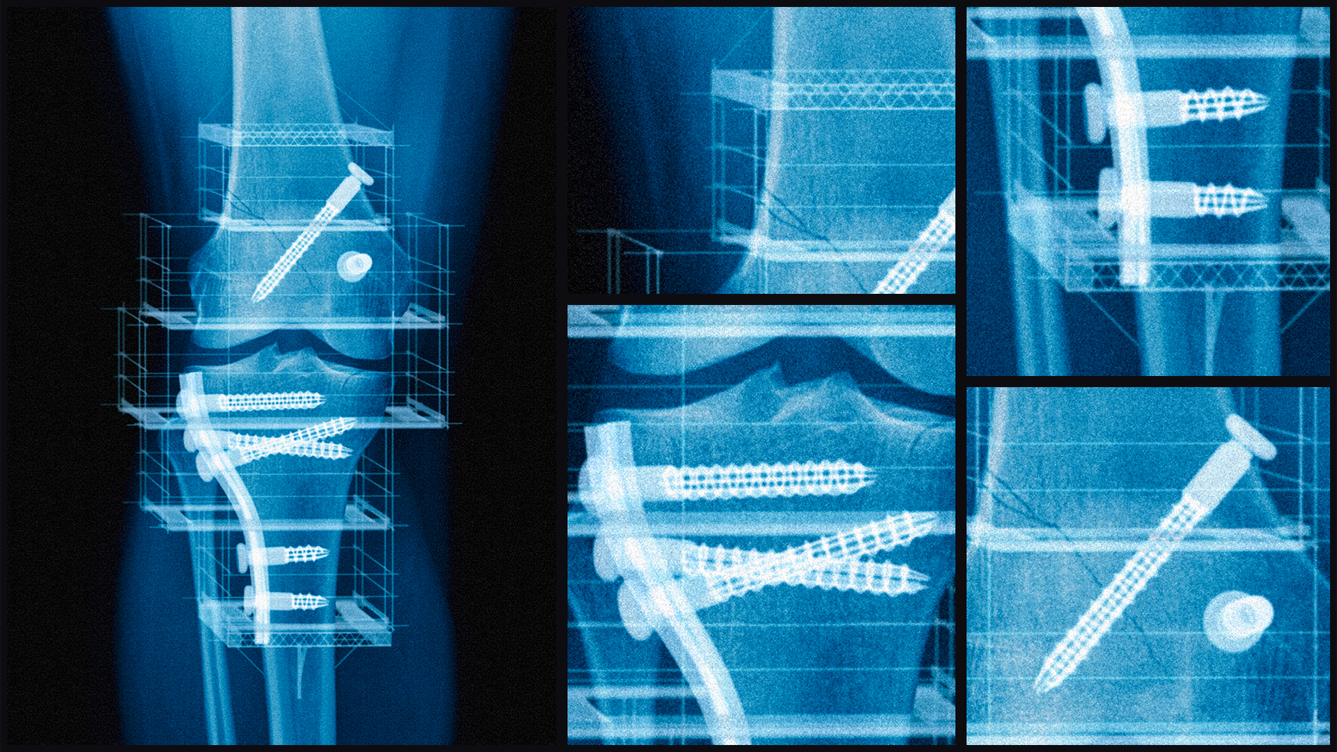 BGBAU_X-Ray_Close-ups_03